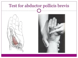 ABDUCTOR POLLICIS BREVIS
